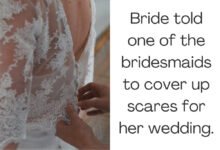 Bride told bridesmaids to cover up scares for her wedding.